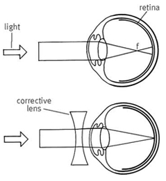Wonder of Light - Part I 